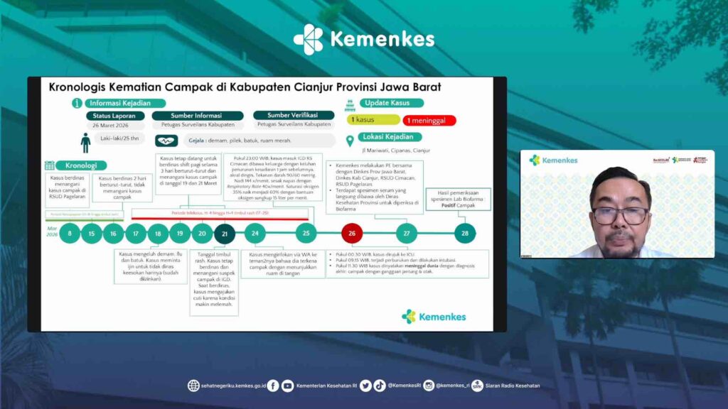 Kemenkes Keluarkan SE Waspada Campak, Tenaga Medis Jadi Prioritas Perlindungan